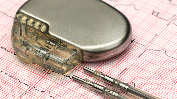 Catholic Health Cardiac Implants Pacemaker