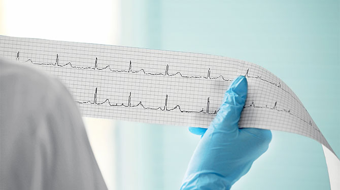 Catholic Health Interventional Cardiac Procedure Heart Monitor